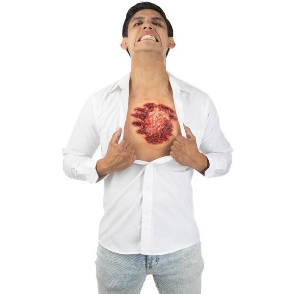 Open Chest FX Appliance Transfer Prosthetic Wound