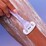 Billie Sparkle Razor Blade Starter Kit each
